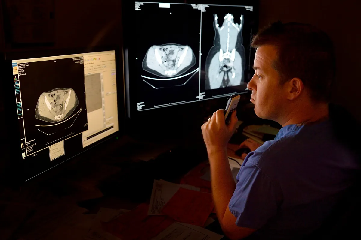 A radiologist in a dark reading room, looking at three monitors with CT scans